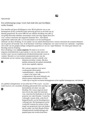 m2001-3 opmerkelijk ben ike.pdf