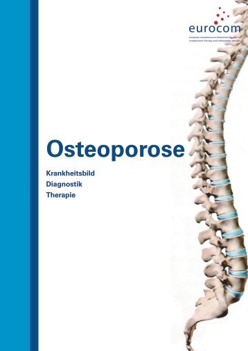 1 / Osteoporose - Eurocom