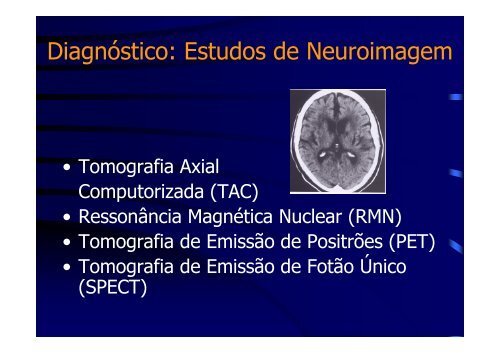 alzheimer do diagnostico ao tratamento - Forma-te