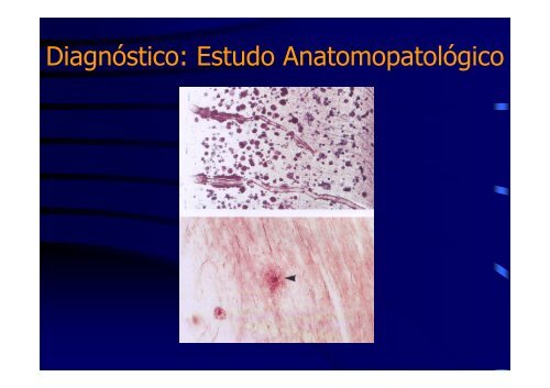 alzheimer do diagnostico ao tratamento - Forma-te