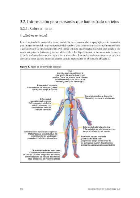 GPC sobre PrevenciÃ³n del Ictus - GuÃ­aSalud