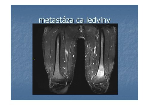 Zobrazovací metody kloubů