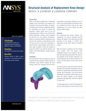 Structural Analysis of Replacement Knee Design - Ansys