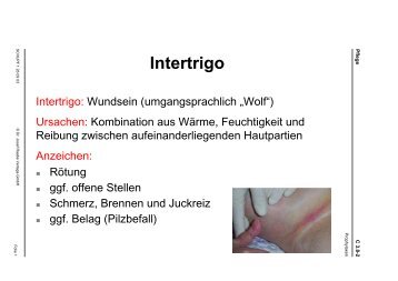 Intertrigoprophylaxe - Ambulante Pflege