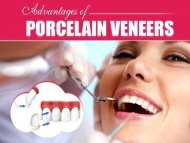 Advantages of Porcelain Veneers