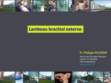 Lambeau brachial externe - e-plastic.fr