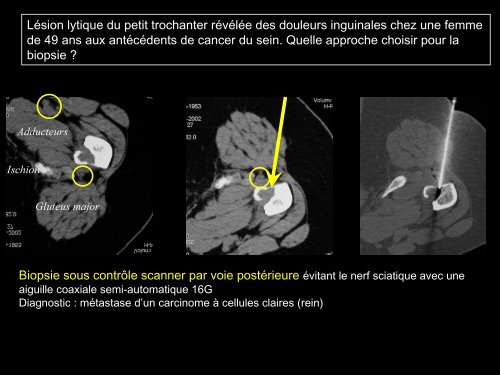 PROCÃDURES INTERVENTIONNELLES DU BASSIN :