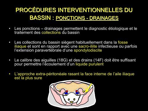 PROCÃDURES INTERVENTIONNELLES DU BASSIN :