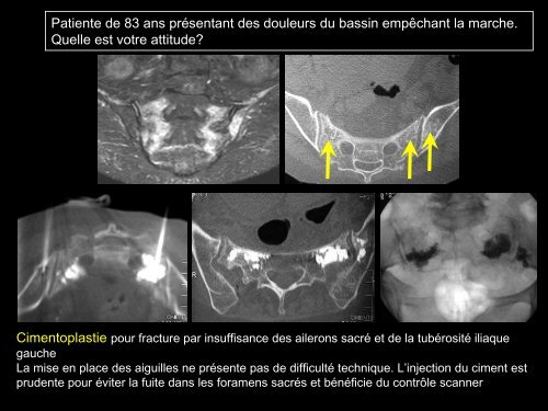 PROCÃDURES INTERVENTIONNELLES DU BASSIN :