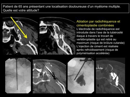 PROCÃDURES INTERVENTIONNELLES DU BASSIN :