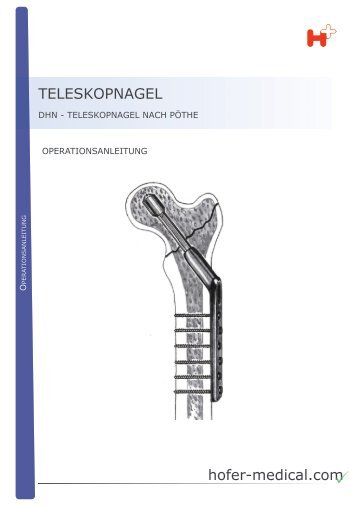 hofer-medical.com TELESKOPNAGEL