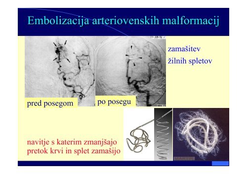 VI Diaskopija - F9