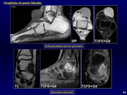 Patología de tobillo y pie