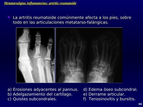 Patología de tobillo y pie