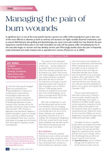 Managing the pain of burn wounds - Wounds UK