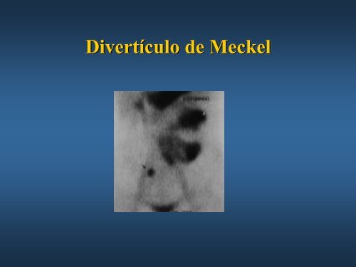 Hemorragia digestiva Oscura - Asociación de Gastroenterología y ...