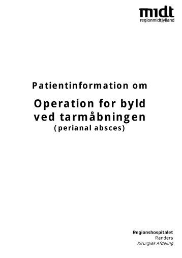 Skridtet bylder behandling i Byld i
