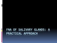 FNA of Salivary glands a practical approach for Sudan