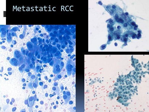 FNA of Salivary glands a practical approach for Sudan