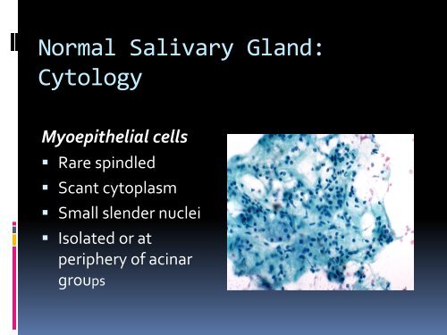 FNA of Salivary glands a practical approach for Sudan