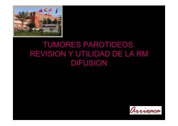 tumores parotideos. revision y utilidad de la rm difusion