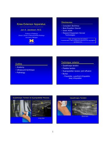 Knee Extensor Apparatus