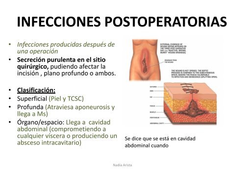 INFECCIONES QUIRURGICAS