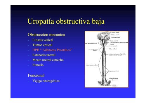 lesión del meato y prostatitis medicitalia