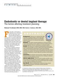 endo vs implant article