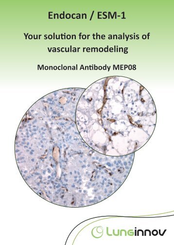 Endocan / ESM-1 - BioNovus Life Sciences