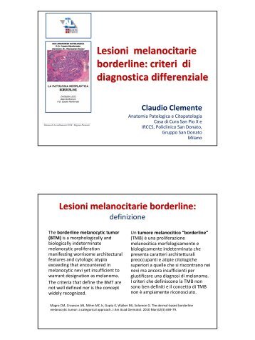 Lesioni melanocitarie borderline: criteri di diagnostica ... - ASL AL