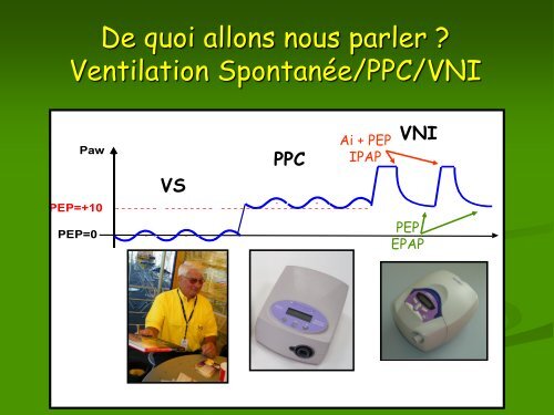 Quand doit-on passer d'une PPC à une VNI - JPRS