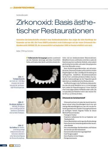 Zirkonoxid: Basis Ã¤sthe- tischer Restaurationen - SHOFU Dental ...
