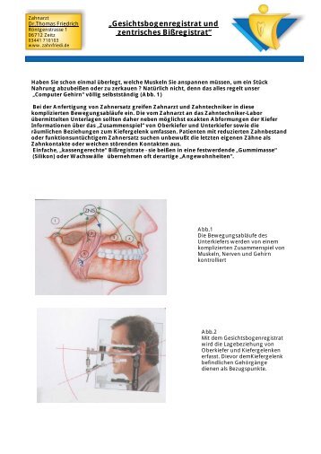 âGesichtsbogenregistrat und zentrisches BiÃregistratâ - Zahnfriedi.de
