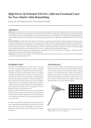 High Power Q-Switched Nd:YAG 1,064-nm Fractional ... - Alma Lasers