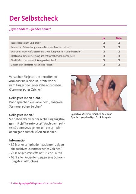 Stau im Gewebe Lymphödeme, Lipödeme - Lymphnetz Hamburg eV