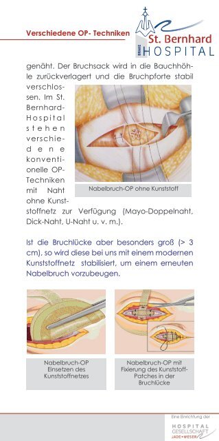 Bauchwandhernien - Krankenhaus Brake