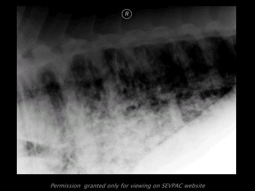 Equine multinodular pulmonary fibrosis (EMPF) in a Thoroughbred filly