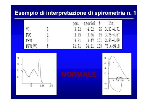 Prove di funzionalitÃ  respiratoria_IVanno.pdf - Clinica malattie ...