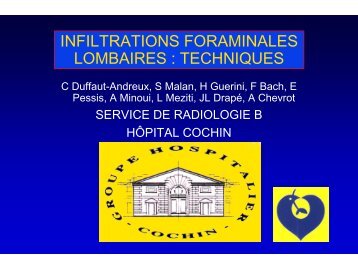 INFILTRATIONS FORAMINALES LOMBAIRES : TECHNIQUES