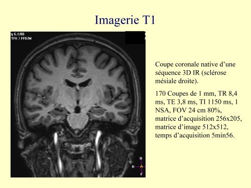 IRM 3T : ExpÃ©rience clinique initiale rennaise en Neuroradiologie