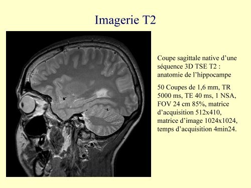 IRM 3T : ExpÃ©rience clinique initiale rennaise en Neuroradiologie