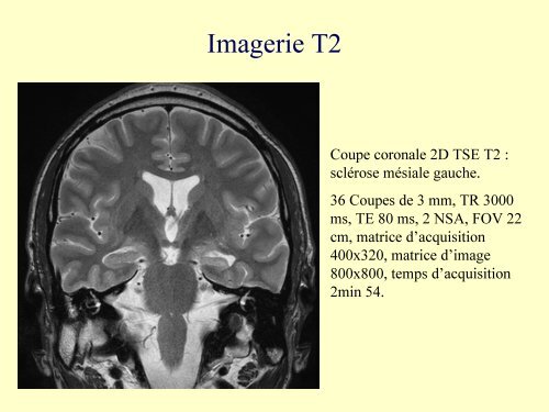 IRM 3T : ExpÃ©rience clinique initiale rennaise en Neuroradiologie