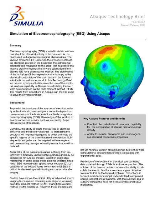 Simulation of Electroencephalography (EEG) Using Abaqus