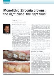 Monolithic Zirconia crowns: the right place, the right time