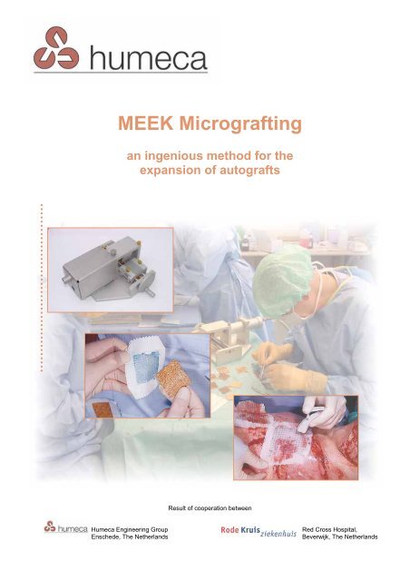 MEEK Micrografting - AFS Medical