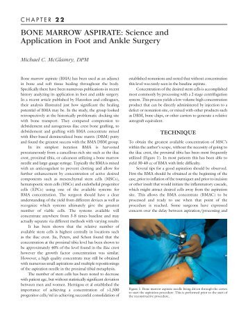 BONE MARROW ASPIRATE - The Podiatry Institute