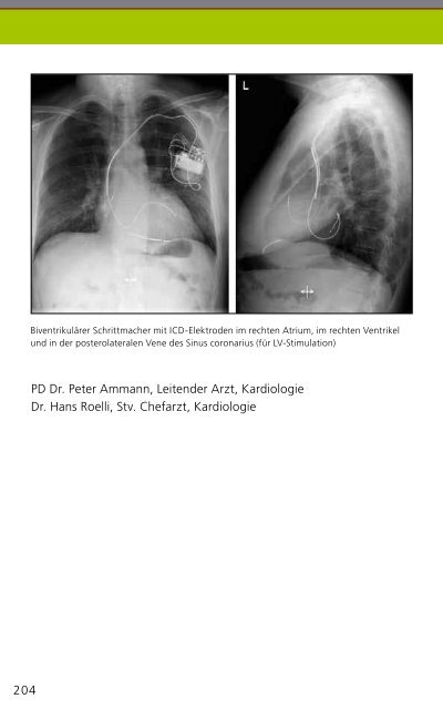 KardiovaskulÃ¤res Manual - No Content (204) - Kantonsspital St. Gallen