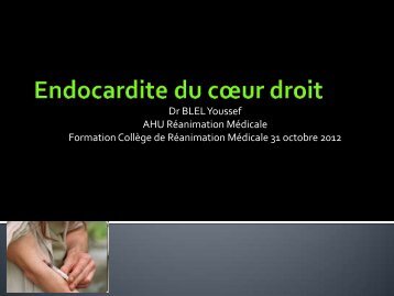 Les endocardites droites .Dr Youssef BLEL - ATuRea