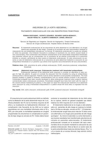 ANEURISMA DE LA AORTA ABDOMINAL: TRATAMIENTO ...